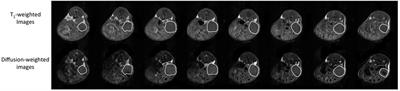 Effect of Pantethine on Ovarian Tumor Progression and Choline Metabolism